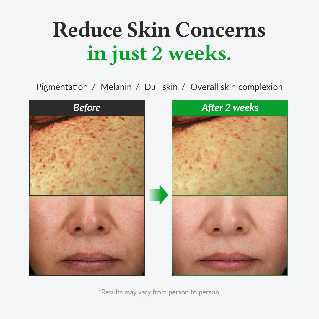 Dr. Althea Gentle 20% Vitamin C Serum 30ml