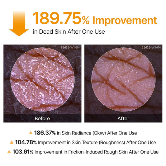 Dr Melaxin Peel Shot Exfoliating Kojic Acid Turmeric Spray 200ml