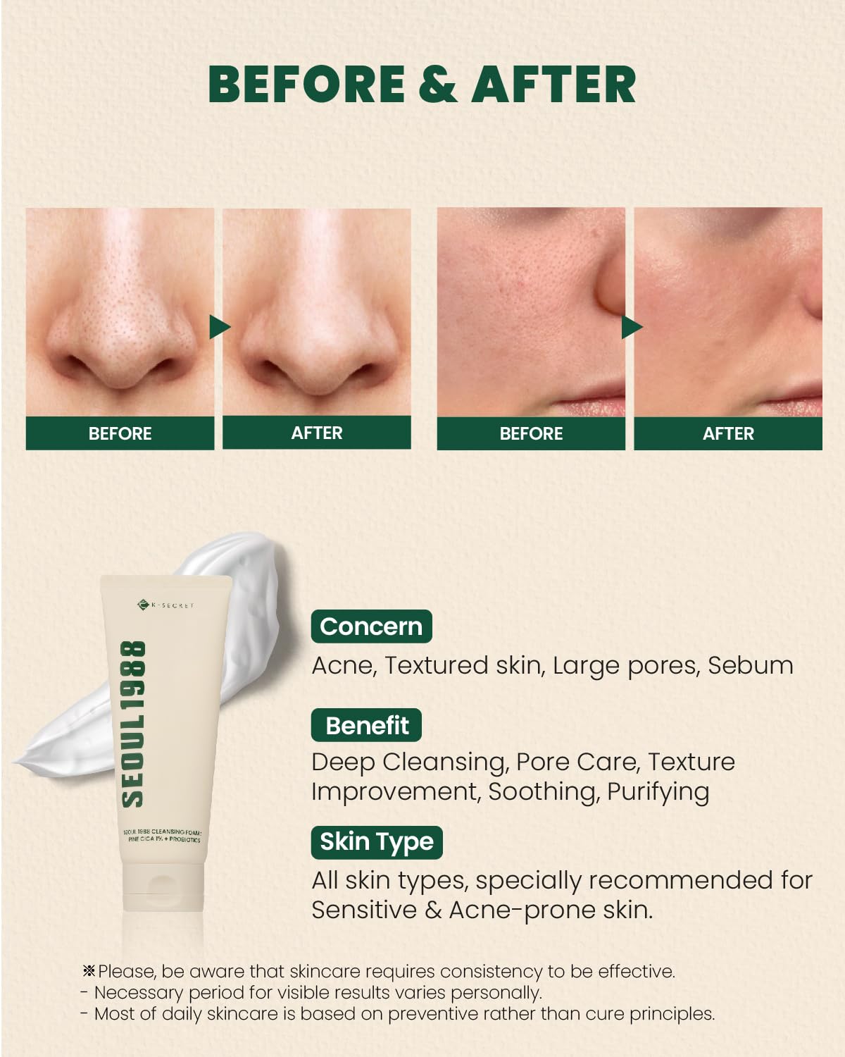 KSECRET SEOUL 1988 (Official) Cleansing Foam Pine Cica 1% + Probiotics 150ml