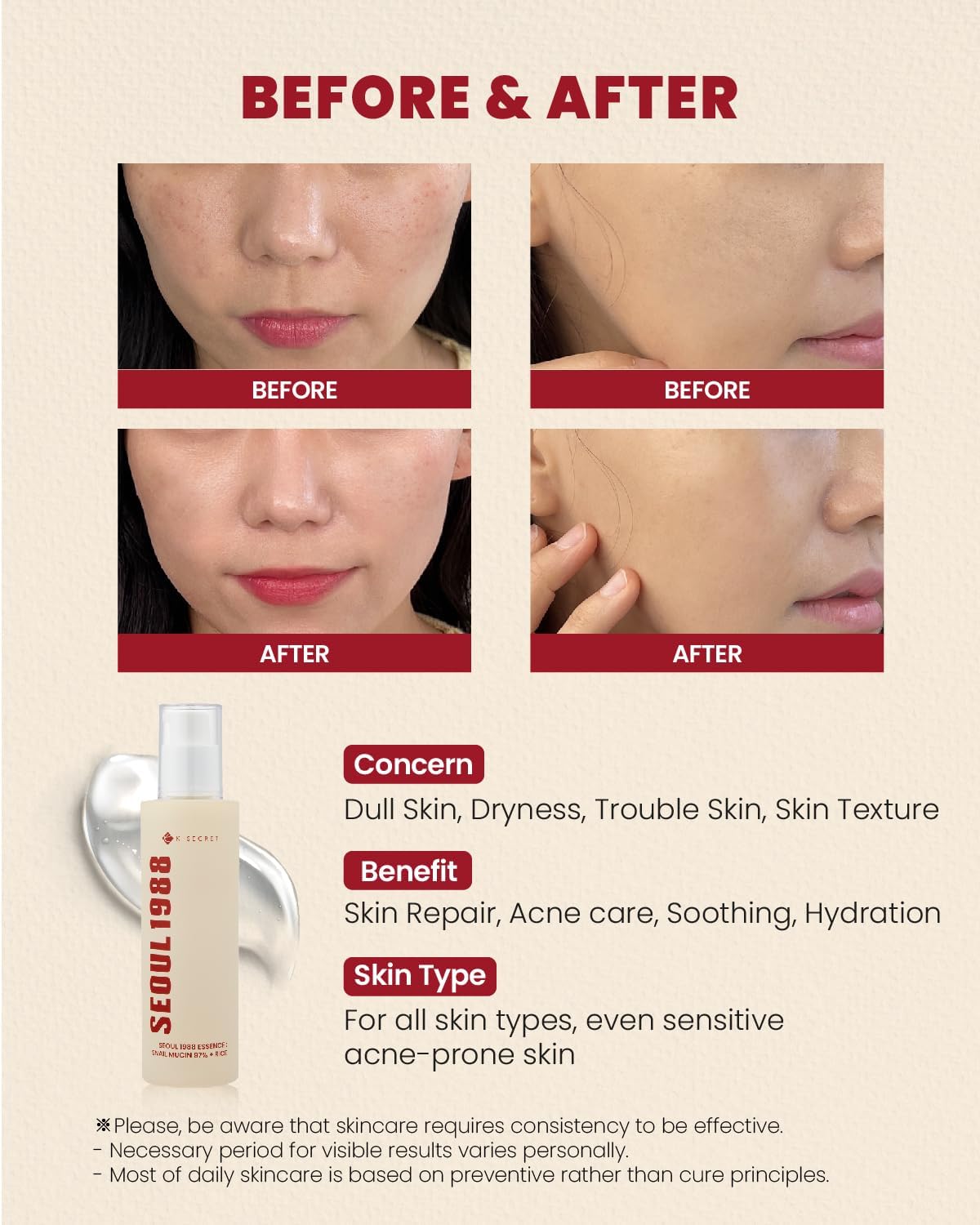 KSECRET SEOUL 1988 (Official) Essence Snail Mucin 97% + Rice 100ml
