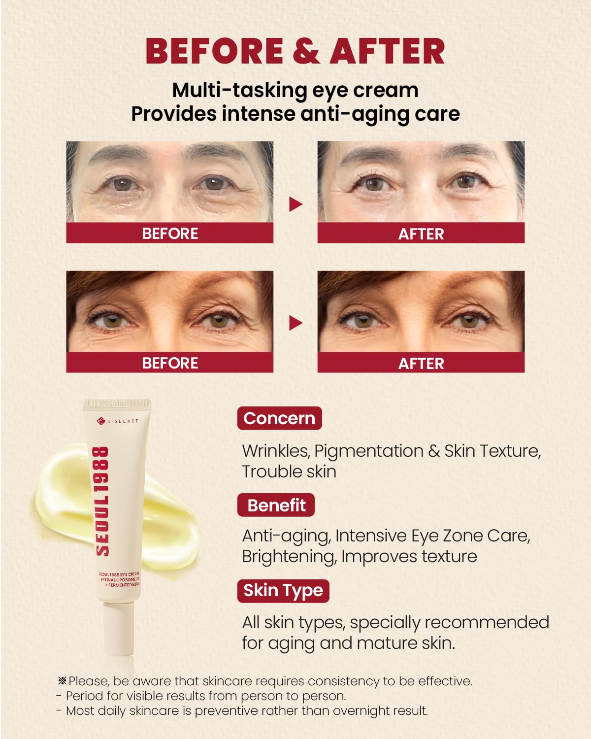 KSECRET SEOUL Eye Cream  before after benefits concern sknin type