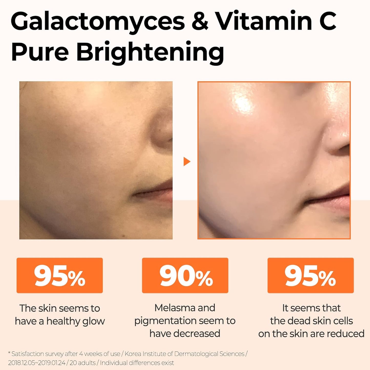 SOME BY MI Galactomyces Pure Vitamin C Glow Serum 30ml