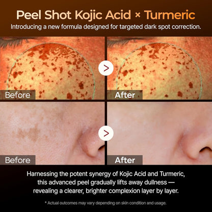 Dr Melaxin Peel Shot Exfoliating Kojic Acid Turmeric Serum 80ml