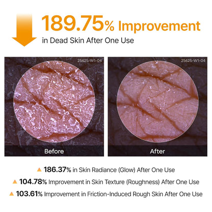 Dr Melaxin Peel Shot Exfoliating Kojic Acid Turmeric Spray 200ml